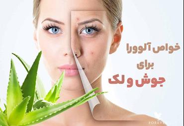 خواص آلوورا برای از بین بردن جوش و لک